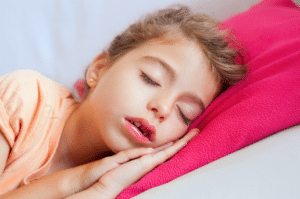 Sleep apnea in children mouth breathing