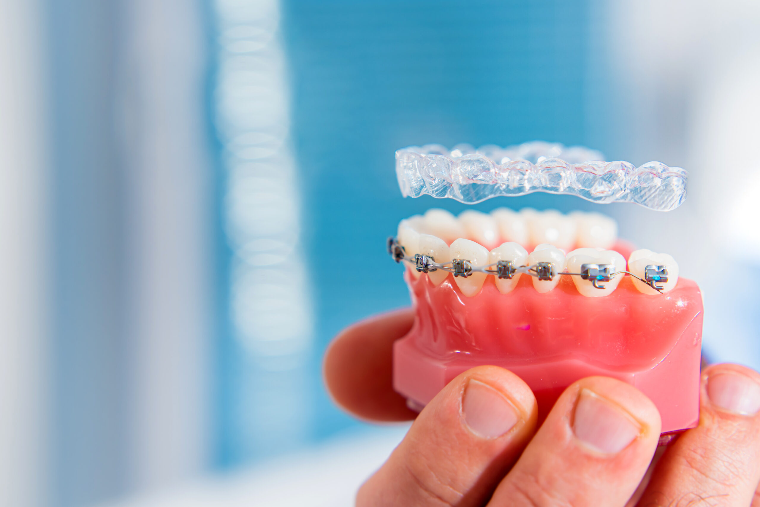 Comparing Invisalign and Braces Which Works Quicker scaled