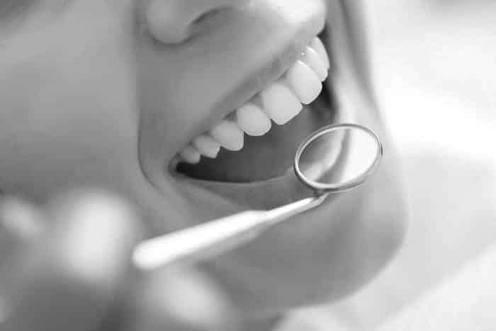 open mouth at dentist