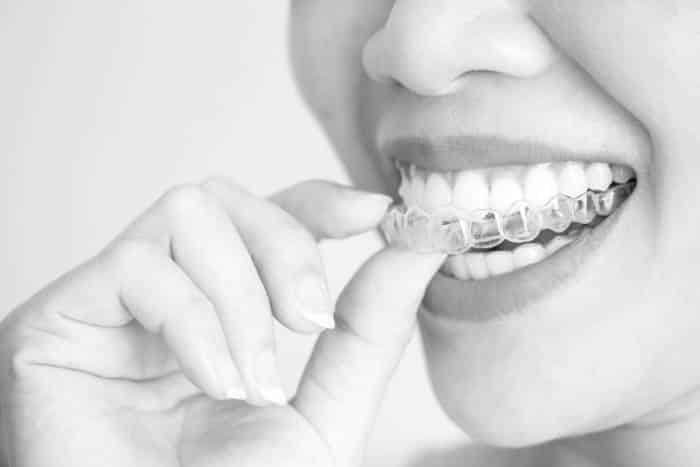 woman taking out Invisalign clear aligners