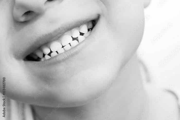 child smiling up close teeth